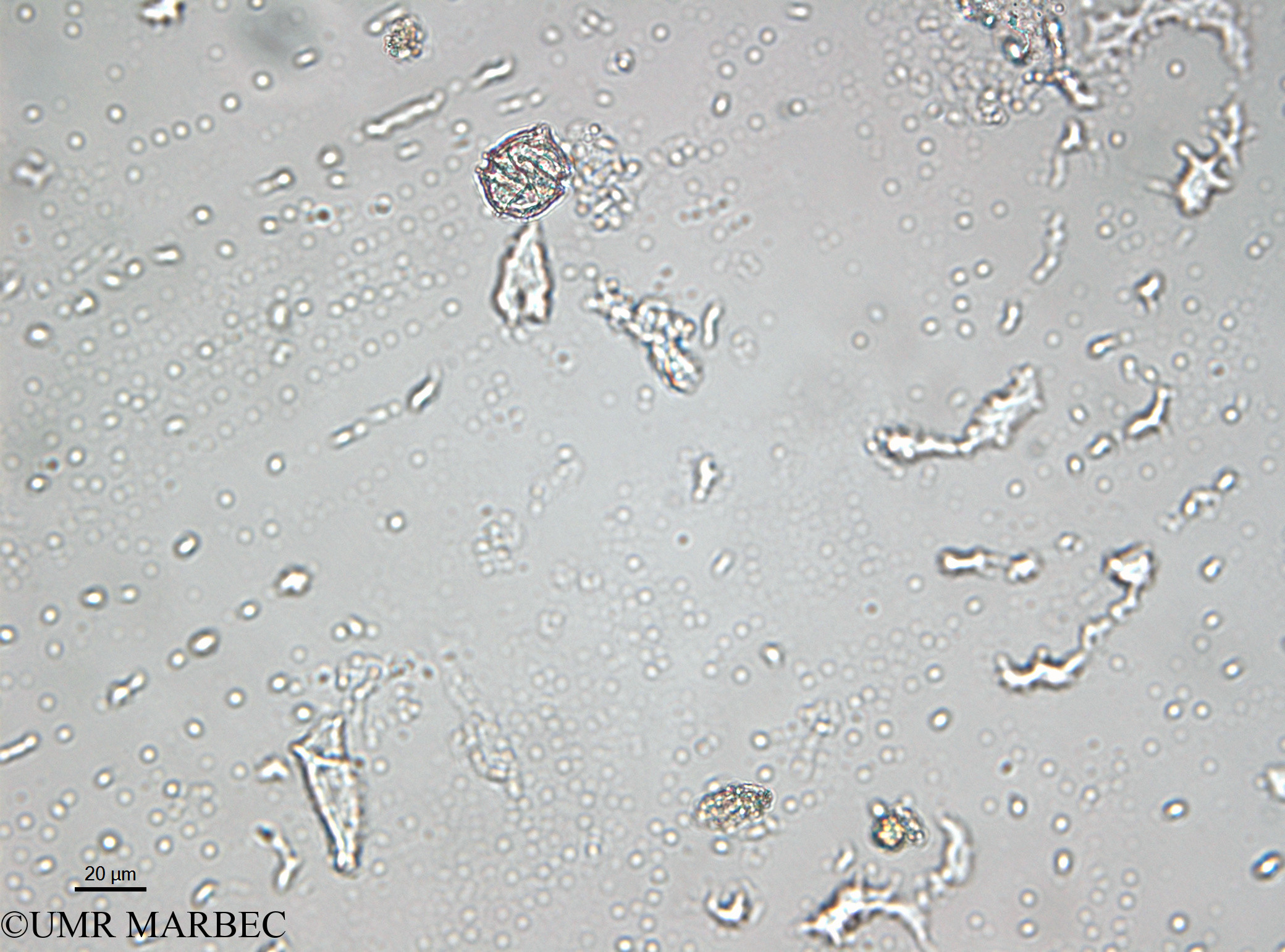 phyto/Bizerte/bizerte_lagoon/RISCO April 2014/Gonyaulax spinifera (- 2140730-4).tif(copy).jpg